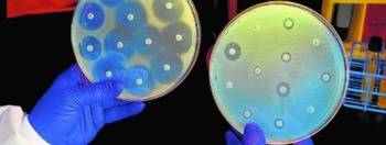 La OMS urge a desarrollar nuevos antibióticos contra bacterias multirresistentes